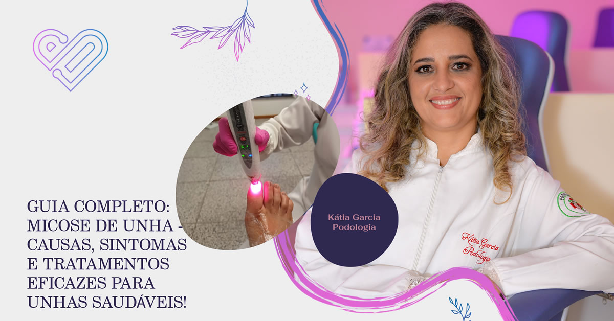 Micose de Unha: Causas, Sintomas e Tratamentos